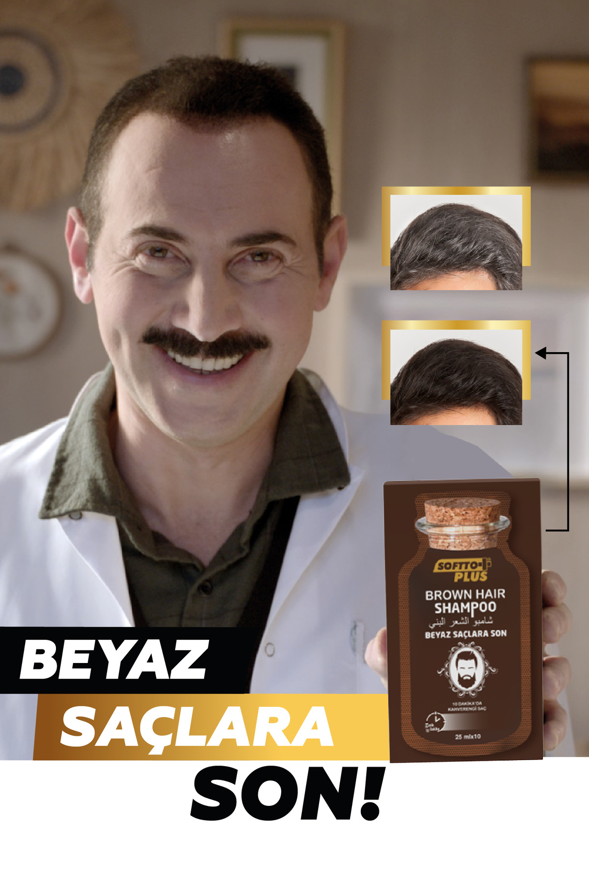 Brown Hair Anında Etkili Beyaz Kapatıcı Koyu Kahverengi Şampuan Boya 25mlx10 KULLANILMLIK FİBER